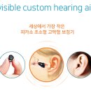 이지보청기 이미지