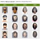 헤어가나 이미지