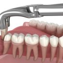 서울라미플란트치과교정과치과의원 이미지
