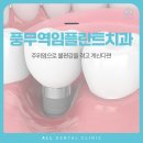 풍무올치과의원 | 풍무역임플란트치과, 주위염으로 불편감을 겪고 계신다면
