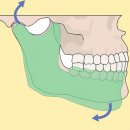 중원치과의원 | 턱관절치료치과, 스플린트 부작용 3분 안에 정리합니다