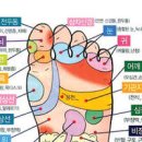 발가락 무좀 원인과 증상 치료 관리법 이미지