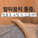 침으로한의원 | 발뒤꿈치 통증 치료, 침 맞아 치료 가능? 홍콩에서 중의학 의원 방문 후기
