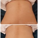 천안 RPC 이미지