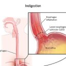 소화 안될때 음식 매실 지압 자세 볼까요? 이미지