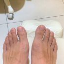 레푸스 수원광교점 | 발톱 무좀 스케일링 레푸스 광교점 정지선 푸스플레게 추천 후기