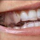 티피치과기공소 이미지