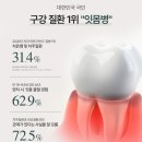 비영 네이버블로그