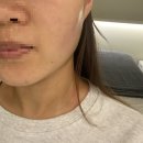 라디아망뷰티 | 아현역피부관리 라디아망뷰티에서 재생볼륨케어