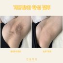 민들왁싱 이미지
