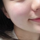 여우야뷰티카페 | エラビエ・リトゥオ スキンブースター、効果がすごかったレビュー