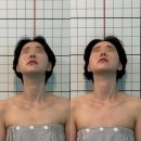동서대학교 디자인전문대학원 | 웰본페이스 안면비대칭 관리 후기｜얼굴 중심축이 달라보였던 강남윤곽관리추천