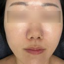 타이팅 메디케어 스킨앤바디 이미지