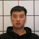 궁인덕치과의원 | 얼굴 비대칭 원인 분석 결과와 진단 비용