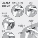 힘줄 이미지
