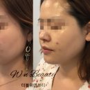 유앤메디칼 | 수성구피부관리실 대구피부관리실 <더블유앤뷰티>최초☆하이푸리푸팅후기😍