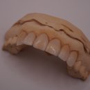 뉴욕치과병원 | 투디치과 블랙필름 라미네이트 가격