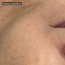 바른코스메디컬 이미지