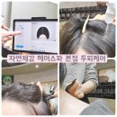 도봉구 두피케어 자연체감 헤어스파 본점 동성제약 제품으로 두피각질 스페셜관리