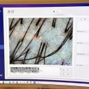 본초제일한방약품 | 강남 두피관리 모클락 두피탈모 강남본점 탈모 초기 발견 후기