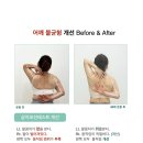 이지핏체형분석운동센터 네이버블로그