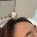 의정부 릴리안왁싱 - 본식 전 페이스왁싱 (헤어라인,눈썹,이마) 받고 온 솔직 후기