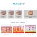 삼양메디칼 | [투자 복기] 2023년 K-피부미용 랠리, 복기하면 보이는 다음 기회!