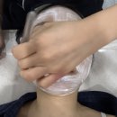 튠플러스 | 압구정 리프팅 병원 튠모드 (튠페이스+인모드) 후기