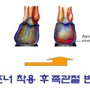 상봉알즈너