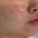 동두천로 | 동두천 지행 피부관리 에스테틱 ‘유얼리뷰티’ 수분관리 후기