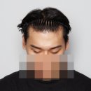 중앙헤어라인 티스토리
