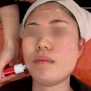 청주 동남지구 피부관리 &#34;예소뷰티&#34; 슈퍼젝션 관리 후기