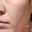 닦토 토너패드 와이트리 듀이패드 실사용후기