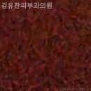 김유찬피부과의원 네이버블로그