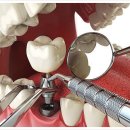 미다스의원 | 영종도치과추천 임플란트 병원 선택, 이것만 확인하면 됩니다.