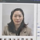 플러스메드 | 통증X, 탄력O &#34;코레지 2.0 에그&#34; +LDM 리프팅 받은 솔직후기ㅣ한달 경과 사진