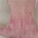 대경메디칼 | 매끈한 피부를 위한 울산리프팅, 대경대학교 뷰티학과 전문성이 빚어낸 비밀