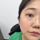 파리바게트 부평현대점 | 부평피부관리 부평에스테틱추천 재생관리 후기 [김선미에스테틱]