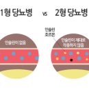 당뇨병과 건강관리 | 1형 당뇨병과 2형 당뇨병의 차이: 당뇨병의 모든 것