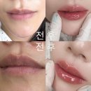보니다미 | 강남입술반영구 보니다미 강남본점 입술 비대칭 교정 상담부터 통증까지 솔직 후기