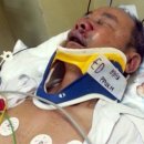 Taxi driver brutally beaten after accident 이미지