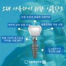 열린치과병원 | 서울열린치과로 전체임플란트 후기 보러 오세요