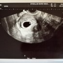 별내마리산부인과의원 이미지