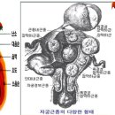 닥터 써니팡의 자궁 근종이야기 이미지