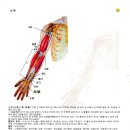 흉수 폐수종 이미지