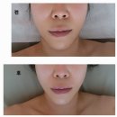 YP SKIN Therapy (YP 스킨 테라피) | 울산 남구 피부관리 스킨더엘 SFT 안면밸런스 리스토어링 후기 윤곽관리 수기 전신관리까지