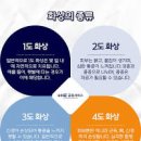 화상 입었을 때 응급처치 방법, 1도 2도 3도 화상 정도와 통증 이미지