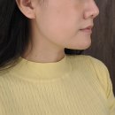 압구정리프팅 웨딩스냅촬영준비 미랩클리닉 히든브이주사 리프팅시술 3차 후기