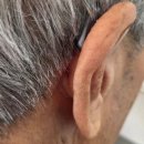 공주보청기 | 공주보청기 오티콘보청기 공주센터 방문후기