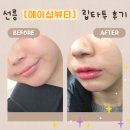 선릉역 입술타투 [에이샵뷰티] 그라데이션 립타투 내돈내산 후기